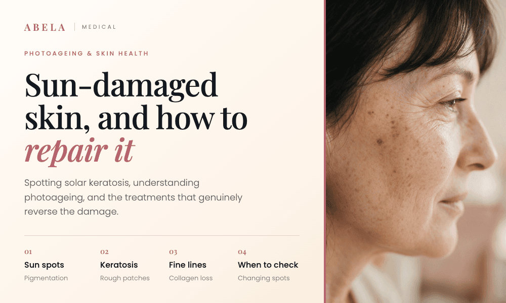 Sun-Damaged Skin: Signs You Should Never Ignore