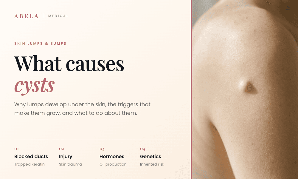 What Causes Cysts? Skin Cyst Causes and Warning Signs